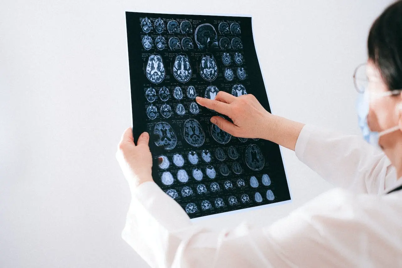 6. Enfermedades cerebrovasculares
