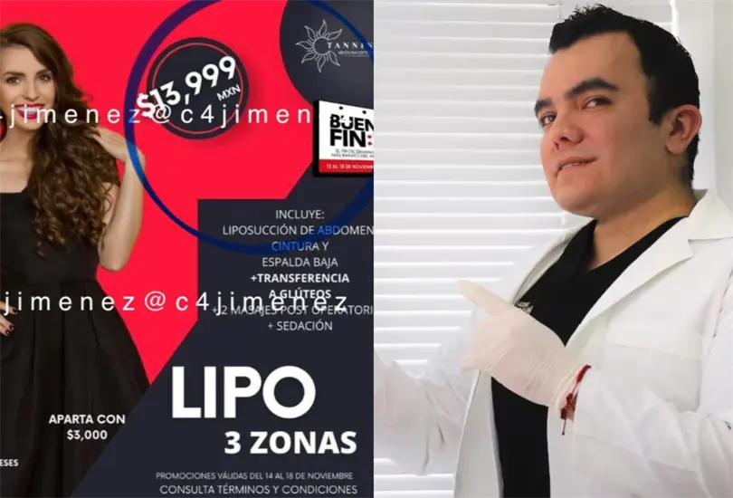 Cirujano oferta procedimientos est&eacute;ticos al 2X1.