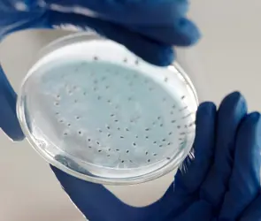 Klebsiella oxytoca: causas y síntomas de la bacteria que puso en alerta al Edomex