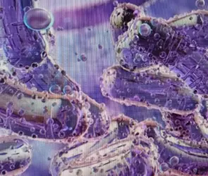 Lo que debes saber sobre el brote causado por Klebsiella oxytoca