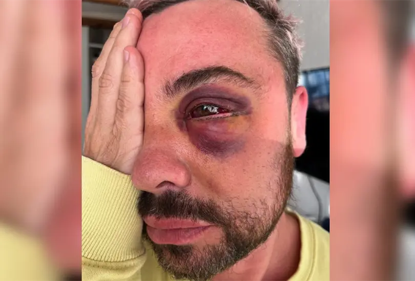 Tras someterse a una cirug&iacute;a.