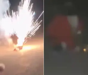 Imágenes impactantes: joven vestido de Santa Claus pierde un ojo tras explosión de cohetes en Navidad