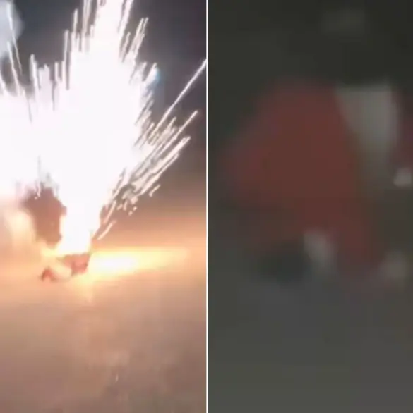 Imágenes impactantes: joven vestido de Santa Claus pierde un ojo tras explosión de cohetes en Navidad