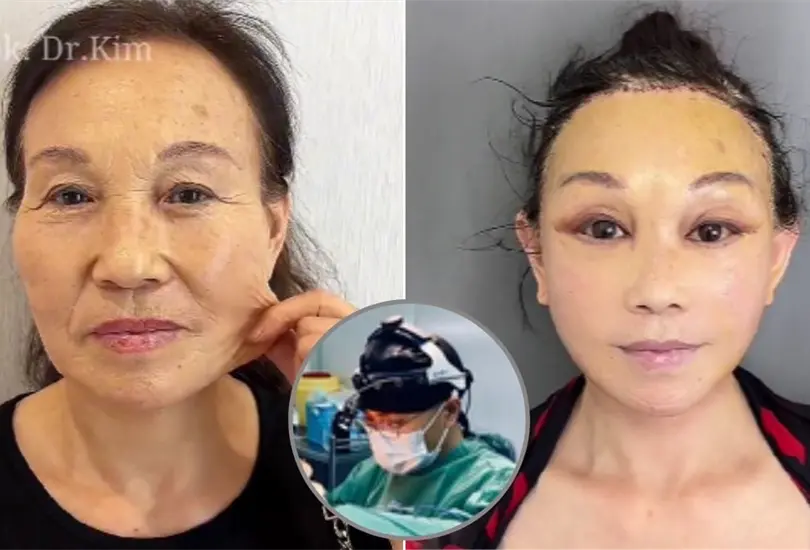 Trabajos del Dr. Kim