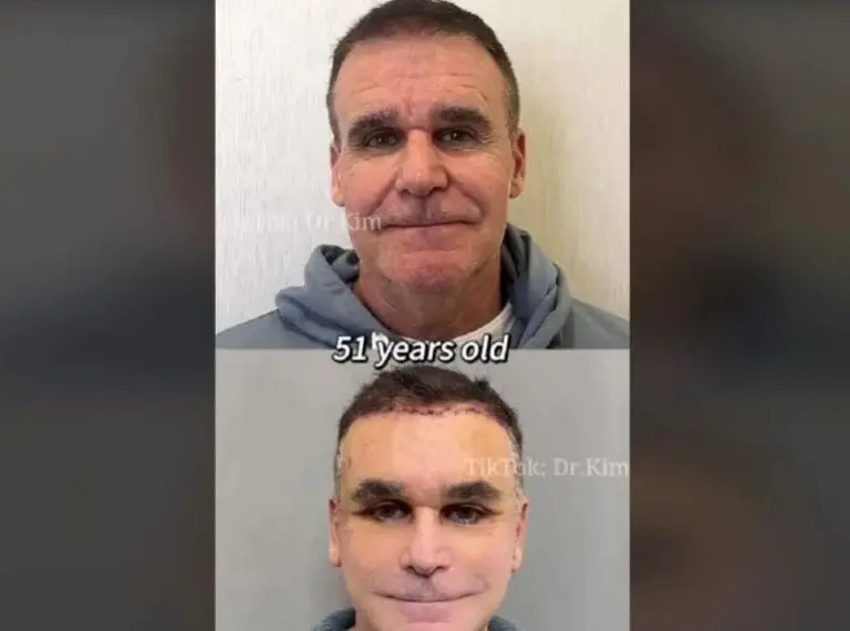 Paciente del Dr. Kim (TikTok)