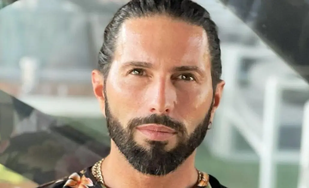 También se realizó una blefaroplastia para rejuvenecer la zona de los ojos.