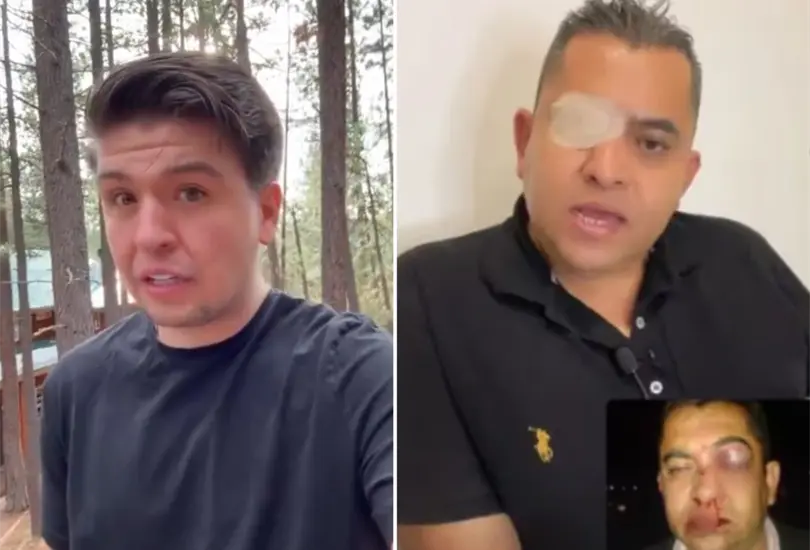 Escolta acusa a Fofo Márquez de golpearlo en una fiesta Escolta acusa a Fofo Márquez de golpearlo en una fiesta