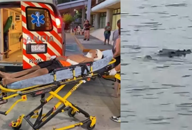 Tragedia en Ixtapa| Cocodrilo muerde a ni&ntilde;o en la cabeza y brazos; padres intentan salvarlo pero son heridos