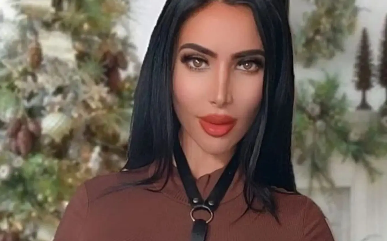 Conocida como la doble de Kim Kardashian. Falleció el 26 de abril de 2023 a los 34 años tras sufrir un paro cardíaco debido a una inyección de silicona en los glúteos en una clínica clandestina.