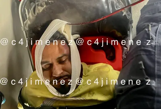 Hombre ebrio orina en la calle y vecinos molestos le entierran varilla en el rostro