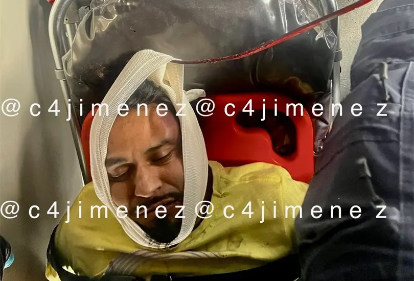 Hombre ebrio orina en la calle y vecinos molestos le entierran varilla en el rostro