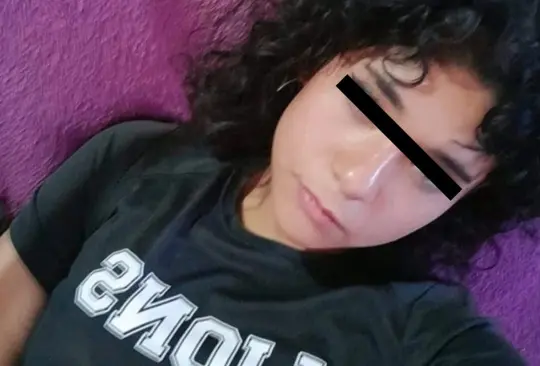 Caso Kimberly: muere joven que fue quemada por su novio porque no le gustaba su forma de vestir