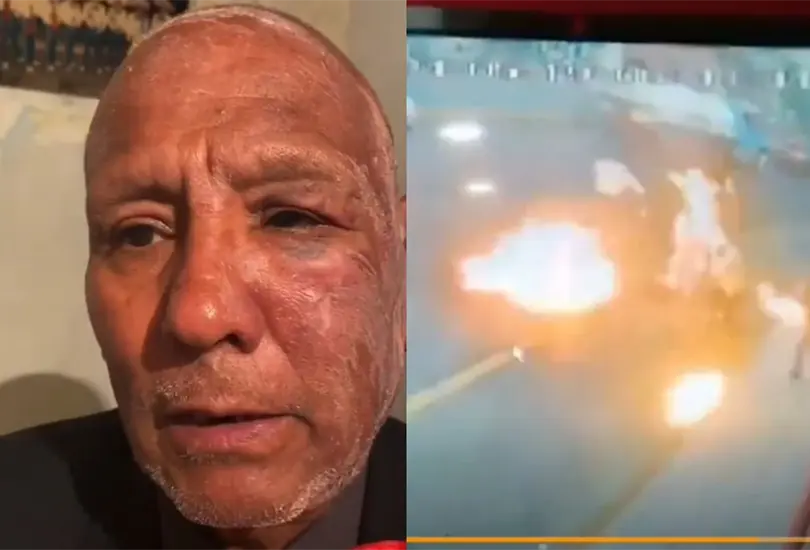 Mariachi quemado por tragafuegos habla sobre la violenta pelea: nos arrebat&oacute; dinero