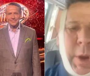 ¿Otra vez se peleó? Alfredo Adame genera alarma al aparecer con el rostro inflamado