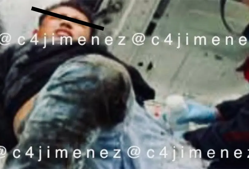 Balean a extorsionador de la Uni&oacute;n Tepito al forcejear con su v&iacute;ctima