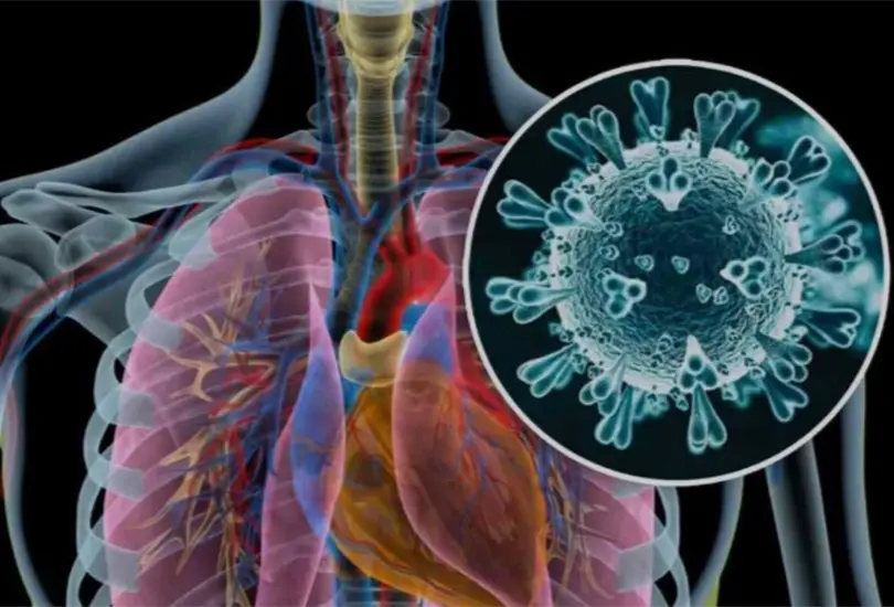 Nuevo Le&oacute;n y Tamaulipas registran los primeros casos de Metapneumovirus humano.