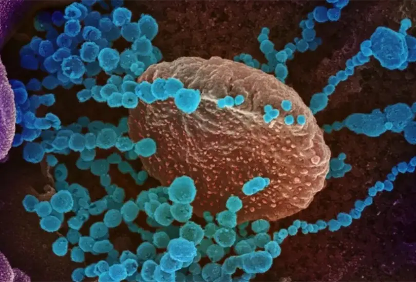 El metapneumovirus ha levantado preocupaci&oacute;n por su propagaci&oacute;n en varios pa&iacute;ses.