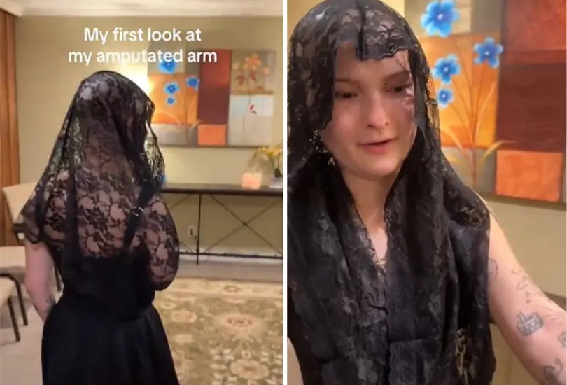 Joven hace funeral a su brazo.