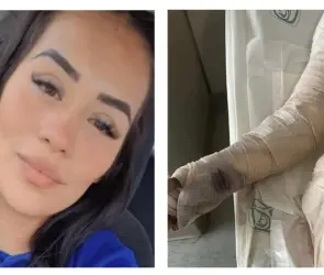 Leticia es abusada y quemada por su vecino al salir a comprar un microondas