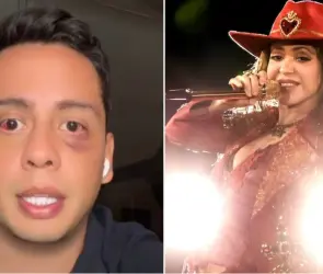 Fan de Shakira es secuestrado y golpeado tras salir del concierto; así fue la aterradora experiencia 