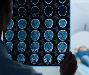 Cinco enfermeras con tumores cerebrales en un solo hospital