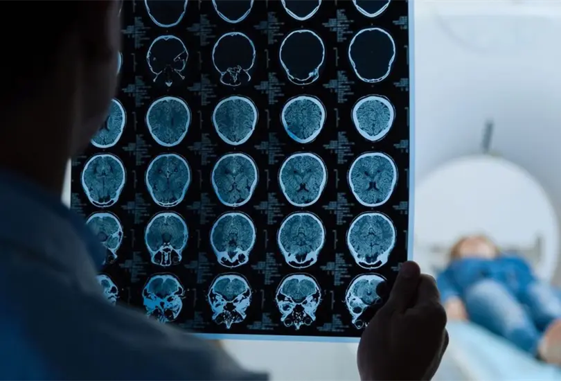 Cinco enfermeras con tumores cerebrales en un solo hospital