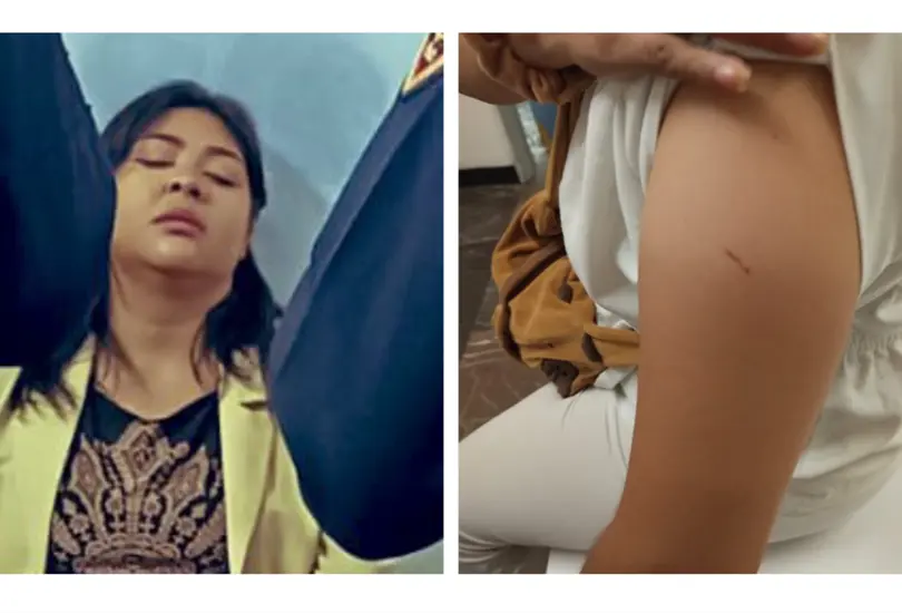 Otra mujer denuncia &acute;pinchazo&acute; en el Metro CDMX; ya van al menos nueve casos