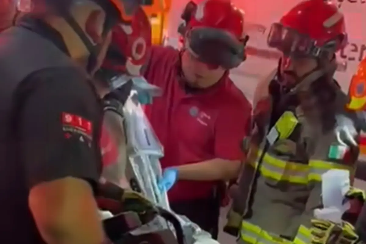  Bebé pierde una mano en accidente con molino de carne 