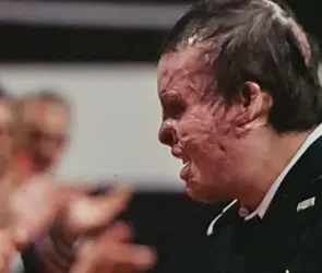 "Me empecé a quemar muy rápido": Así fue el atentado al que sobrevivió el suboficial Iván Morales, ejecutado este miércoles por el CJNG