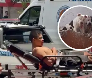 Hombre es atacado por seis pitbull en su casa de Santa María la Ribera