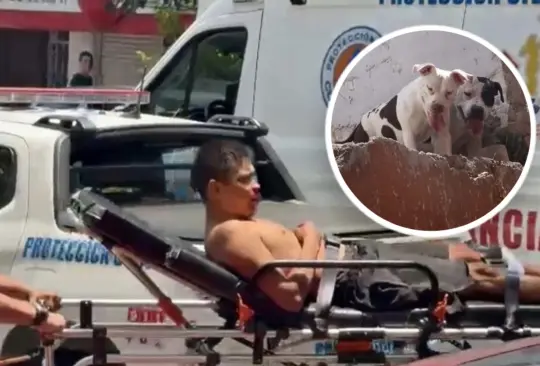Hombre es atacado por seis pitbull en su casa de Santa María la Ribera Hombre es atacado por seis pitbull en su casa de Santa María la Ribera