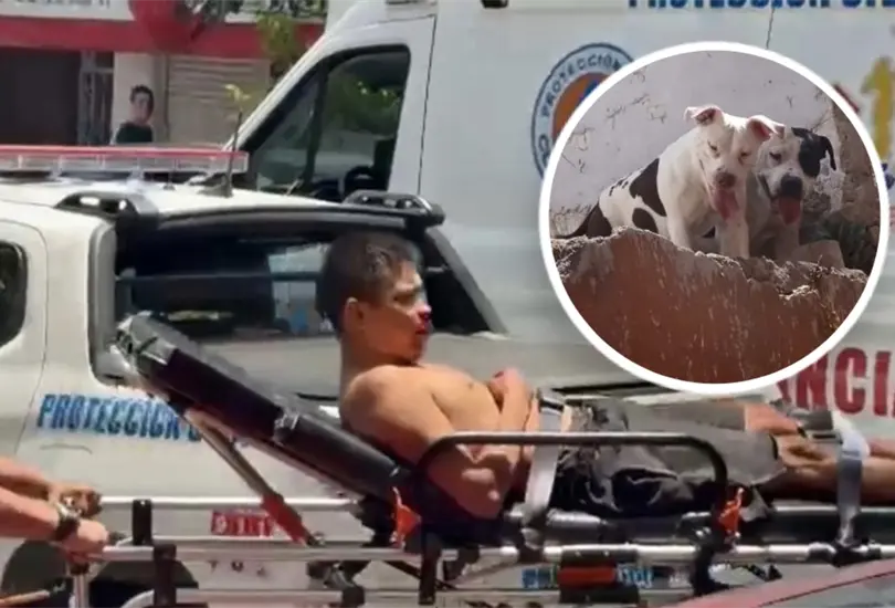 Hombre es atacado por seis pitbull en su casa de Santa María la Ribera Hombre es atacado por seis pitbull en su casa de Santa María la Ribera