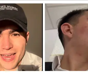 ¿Quién es Ru Abogado? El tiktoker que acusa a policías de CDMX de golpiza y robo