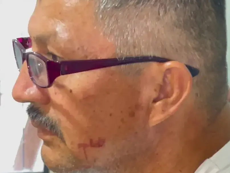 Salvador Chávez afirmó que tras la agresión no recibió atención médica adecuada. Especial