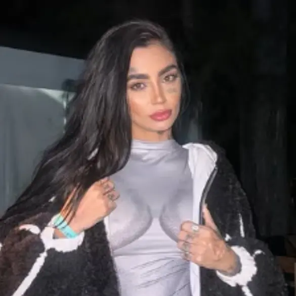 Ana Bárbara Buhr muere tras cirugpia estética gratuita; una noche antes se fue de fiesta con el cirujano