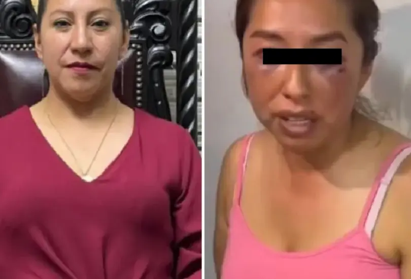 La edil es acusada de participar en una agresi&oacute;n f&iacute;sica, verbal y sexual.