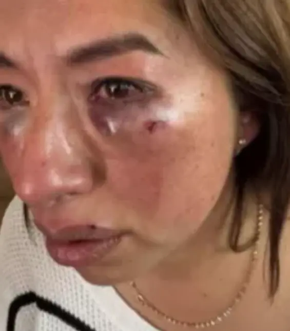 La trabajadora fue brutalmente golpeada. Especial.
