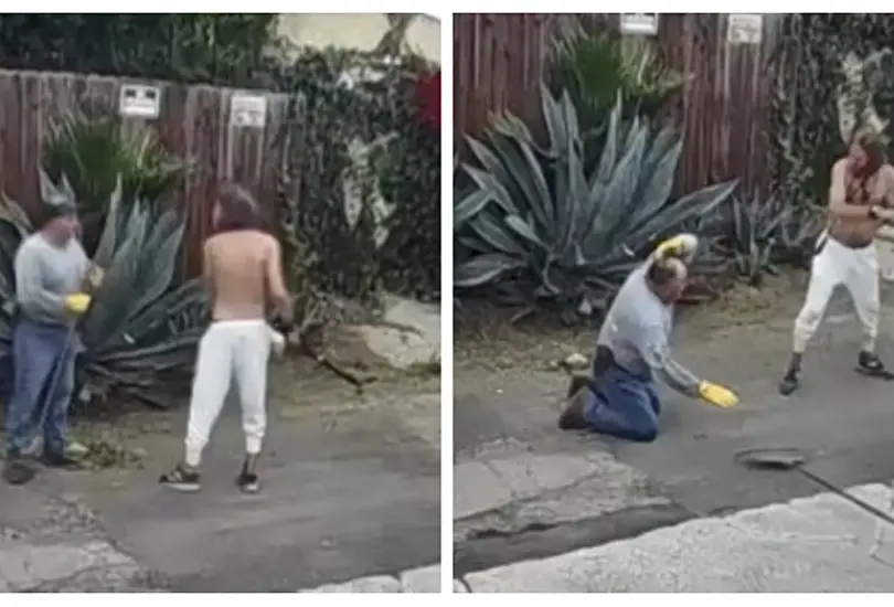 Caso Rodolfo Roman: jardinero es atacado a palazos por hacer mucho ruido