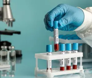 Descubren un nuevo grupo sanguíneo, sólo una persona en el mundo lo tiene