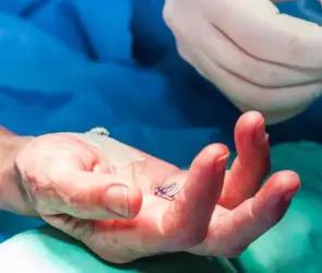 Cirujana opera dedo equivocado, paciente exige indemnización millonaria