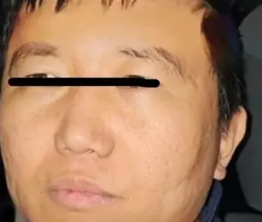 Se fuga Zhi Dong Zhang, operador chino ligado al CJNG y al Cártel de Sinaloa en Cuajimalpa