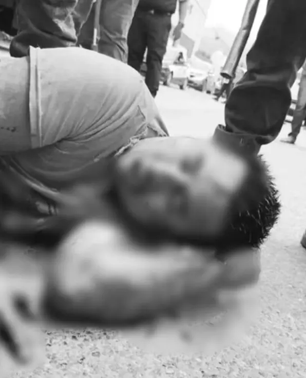 El hombre fue golpeado violentamente. X.