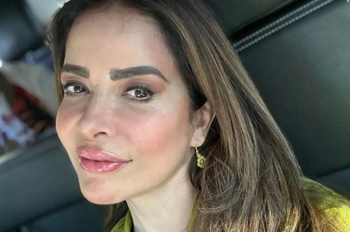 Entre los procedimientos que se ha realizado están: una rinoplastia, un estiramiento facial, la aplicación de bótox en los pómulos y ácido hialurónico en los labios.