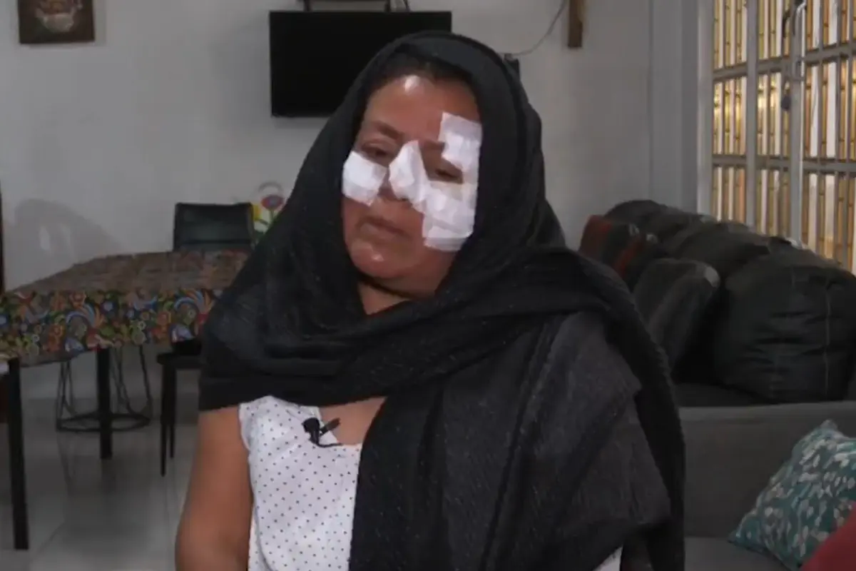  Explosión Iztapalapa: profesora vio a joven envuelto en llamas 
