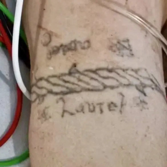 Buscan identificar a joven herida en explosión de pipa en Iztapalapa por tatuajes en el brazo