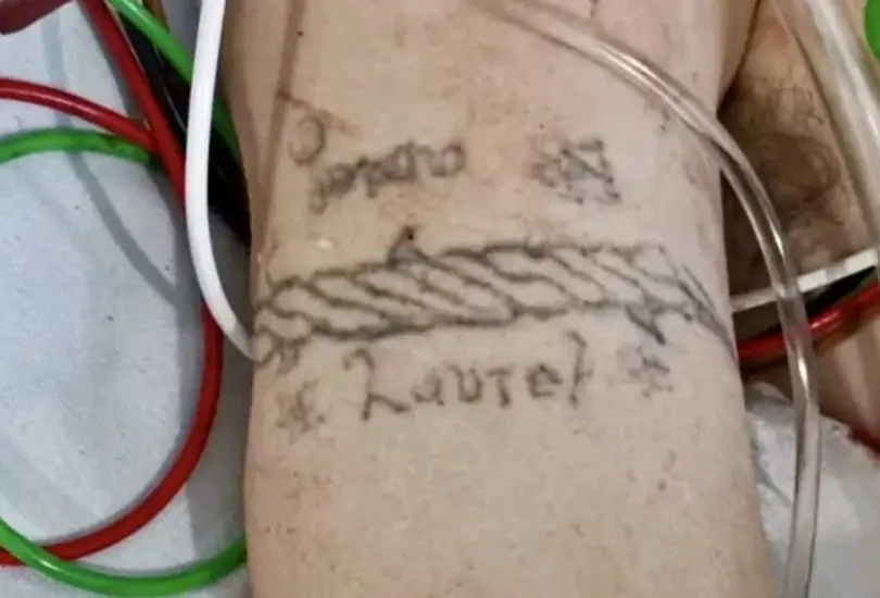 Buscan identificar a joven herida en explosión de pipa en Iztapalapa por tatuajes en el brazo
