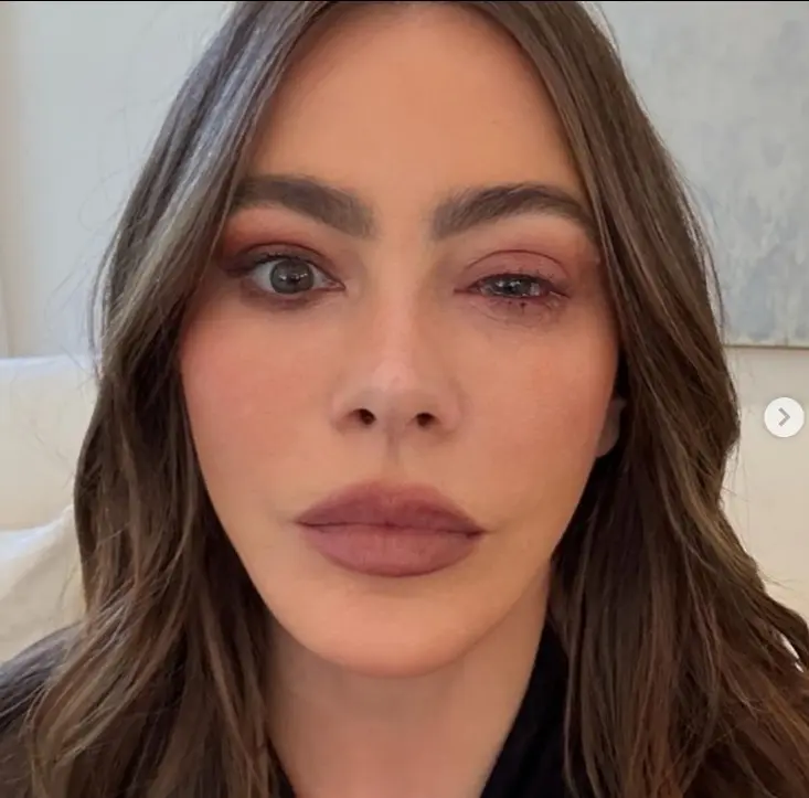 Sofía Vergara sufre alergia Instagram