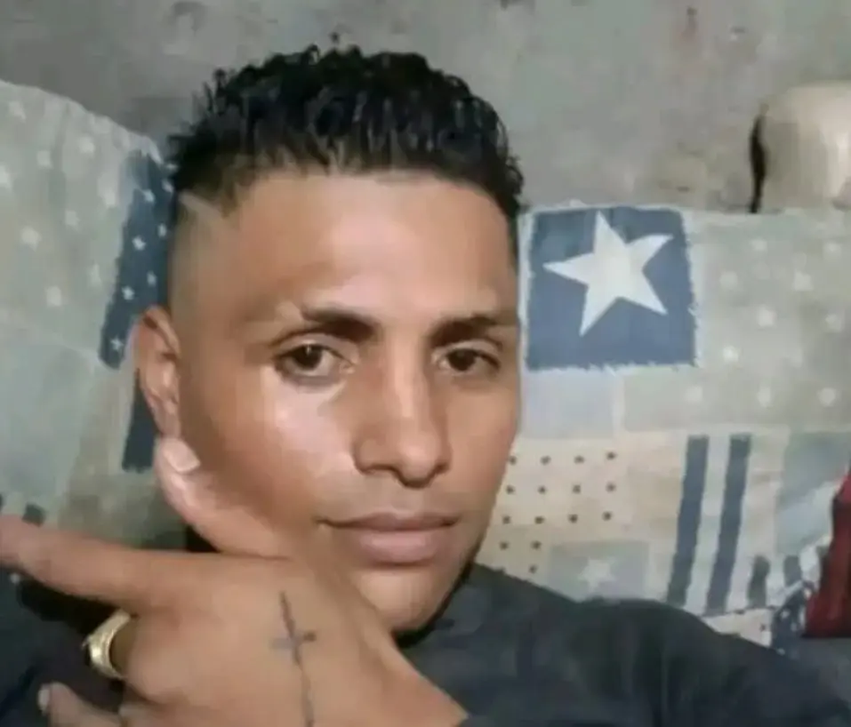 Erick Vicente tiene quemaduras en todo su cuerpo. Especial.