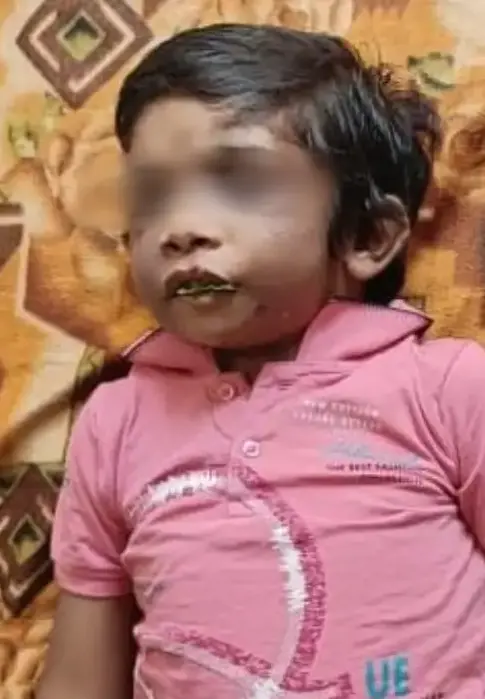 El pequeño murió debido a la gravedad de las heridas. X.