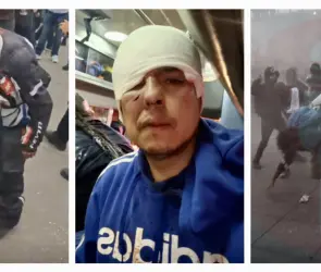 Fotoperiodistas lesionados en marcha del 2 de Octubre en CDMX: uno hospitalizado y dos con golpes en la cabeza